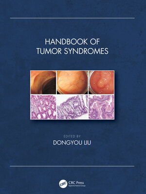 cover image of Handbook of Tumor Syndromes